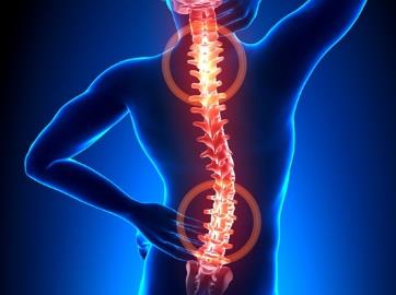 Sciatica Pain Relief without Drugs or Surgery - Beeson Wellness Center